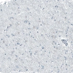 Immunohistochemical staining of human cerebral cortex shows no positivity in neurons as expected.