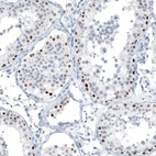 Anti-CHEK2 Antibody