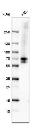 Western blot analysis in human cell line HEL.