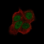 Immunofluorescence staining of MCF7 cells using the Anti-CHEK2 monoclonal antibody, showing specific staining in the nucleus in green. Microtubule- and nuclear probes are visualized in red and blue, respectively (where available).