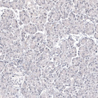 Anti-PAX2 Antibody