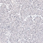 Immunohistochemical staining of human pancreas shows no positivity in exocrine glandular cells as expected.