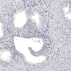 Anti-PAX2 Antibody