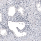 Immunohistochemical staining of human prostate shows no positivity in glandular cells as expected.