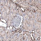 Immunohistochemical staining of human kidney shows strong nuclear positivity in cells in distal tubules.