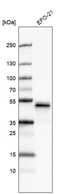 Western blot analysis in human cell line EFO-21.