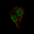Immunofluorescence staining of EFO-21 cells using the Anti-PAX2 monoclonal antibody, showing specific staining in the nucleoplasm in green. Microtubule- and nuclear probes are visualized in red and blue, respectively (where available).