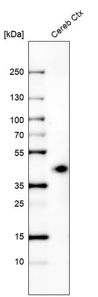 Anti-B3GAT1 Antibody