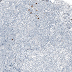 Anti-B3GAT1 Antibody