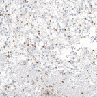 Anti-B3GAT1 Antibody