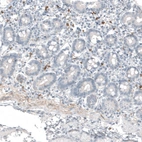 Immunohistochemical staining of human duodenum shows moderate cytoplasmic positivity in lymphoid cells.