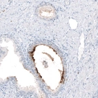 Immunohistochemical staining of human prostate shows moderate to strong staining of secretion.