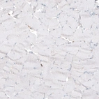 Immunohistochemical staining of human skeletal muscle shows no positivity in myocytes as expected.