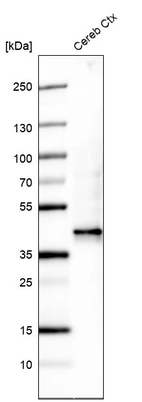 Western blot analysis in human cerebral cortex tissue.