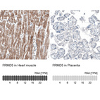 Anti-FRMD5 Antibody