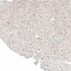 Anti-FRMD5 Antibody