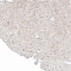 Immunohistochemical staining of human cerebral cortex shows weak to moderate positivity in neuronal processes.