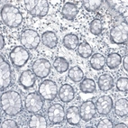 Immunohistochemical staining of human colon shows no positivity in glandular cells as expected.