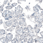 Anti-FRMD5 Antibody