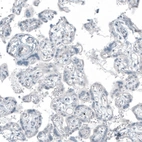 Immunohistochemical staining of human placenta shows no positivity in trophoblastic cells as expected.