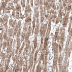 Immunohistochemical staining of human heart muscle shows moderate cytoplasmic positivity in cardiomyocytes.