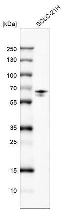 Western blot analysis in human cell line SCLC-21H.