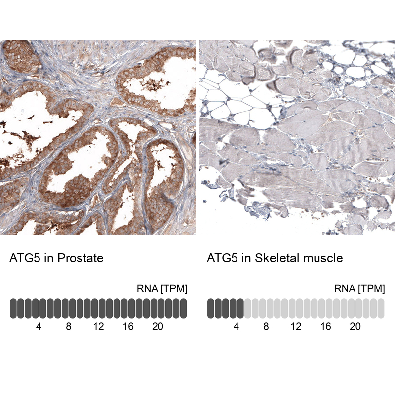 Anti-ATG5 Antibody