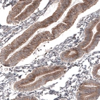 Immunohistochemical staining of human endometrium shows moderate cytoplasmic positivity in glandular cells.