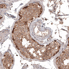 Immunohistochemical staining of human testis shows moderate to strong cytoplasmic positivity in cells in seminiferous ducts.