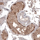 Immunohistochemical staining of human testis shows moderate to strong cytoplasmic positivity in cells in seminiferous ducts.