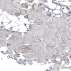 Immunohistochemical staining of human skeletal muscle shows no positivity in myocytes as expected.