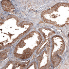 Anti-ATG5 Antibody