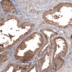 Immunohistochemical staining of human prostate shows strong cytoplasmic positivity in glandular cells.
