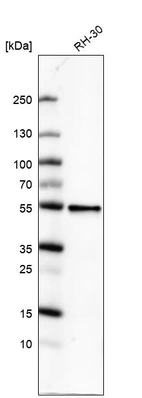 Western blot analysis in human cell line RH-30.
