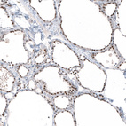 Anti-PIK3CB Antibody