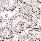 Immunohistochemical staining of human testis shows moderate to strong nuclear positivity in cells in seminiferous ducts.