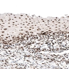 Immunohistochemical staining of human cervix shows strong nuclear positivity in squamous epithelial cells.
