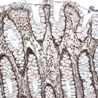 Immunohistochemical staining of human colonshows strong nuclear positivity in glandular cells.
