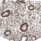 Immunohistochemical staining of human endometrium shows strong nuclear positivity in glandular cells.