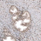 Immunohistochemical staining of human prostate shows moderate nuclear positivity in glandular cells.