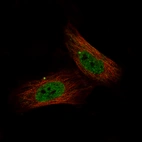 Immunofluorescence staining of U-251 MG cells using the Anti-JUN monoclonal antibody, showing specific staining in the nucleoplasm and aggresomes in green. Microtubule- and nuclear probes are visualized in red and blue, respectively (where available).