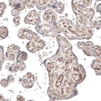 Immunohistochemical staining of human placenta shows moderate membranous positivity in endothelial cells.