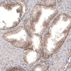 Immunohistochemical staining of human prostate shows moderate membranous positivity in glandular cells.