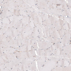 Immunohistochemical staining of human skeletal muscle shows no positivity in myocytes as expected.