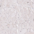 Immunohistochemical staining of human skeletal muscle shows no positivity in myocytes as expected.