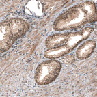 Anti-SMAD4 Antibody