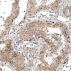 Immunohistochemical staining of human testis shows moderate nuclear and cytoplasmic positivity in cells in seminiferous ducts.