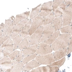 Immunohistochemical staining of human skeletal muscle shows very weak cytoplasmic positivity in myocytes.