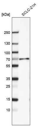 Western blot analysis in human cell line SCLC-21H.