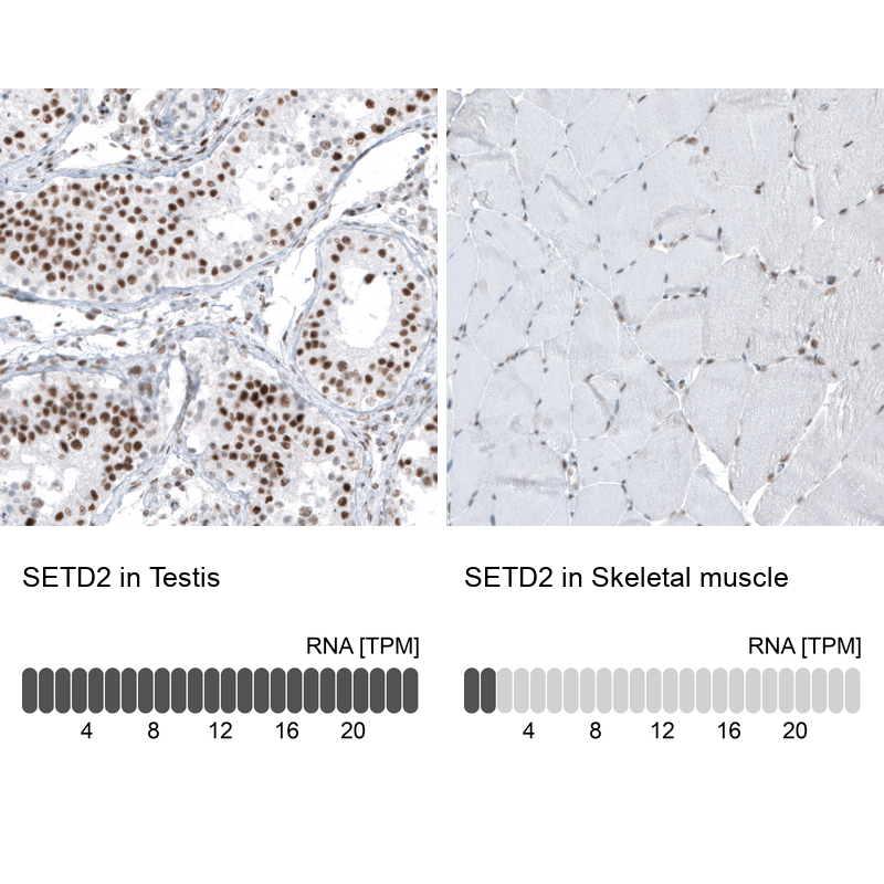 Anti-SETD2 Antibody